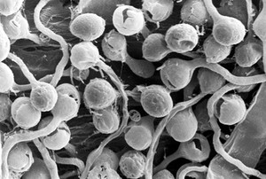 view SEM Pythium zoospores germinating on root