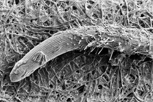 view SEM Pythium spores on root tip