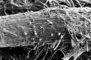 view SEM Pythium spores germinating on root tip