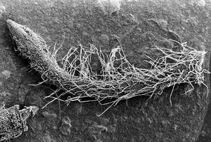 view SEM Pythium spores germinating on root tip