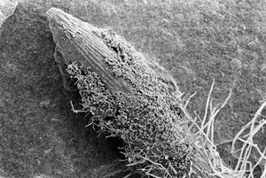 view SEM Pythium spores germinating on root tip