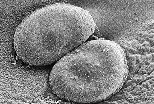 view SEM of Streptococcus pneumoniae colony