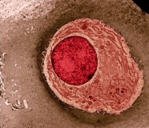 view Chondrocyte showing organelles - coloured