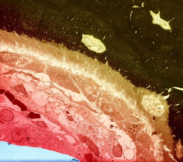 Calcified bone interface, col - red/yellow