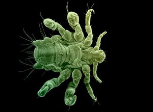 view Pubic louse, ventral view, SEM, colour-green