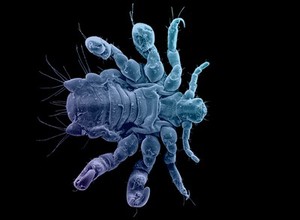 view Pubic louse, ventral view, SEM, colour- blue