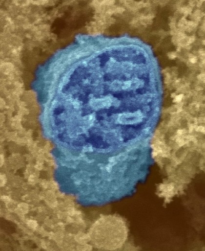 Mitochondrion (blue) surrounded by cytoplasm