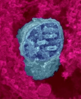 Mitochondrion (blue) surrounded by cytoplasm