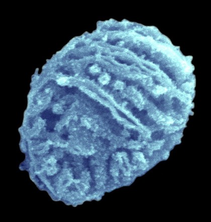 An isolated mitochondrion fractured to reveal the internal structure. The internal membranes