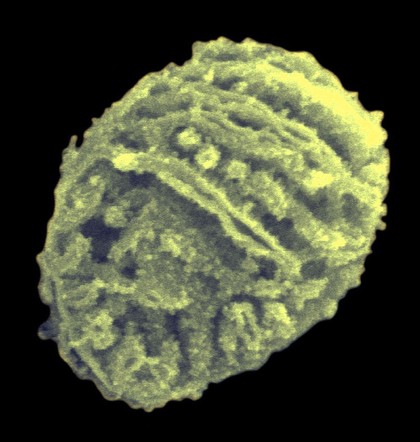 An isolated mitochondrion fractured to reveal the internal structure. The internal membranes