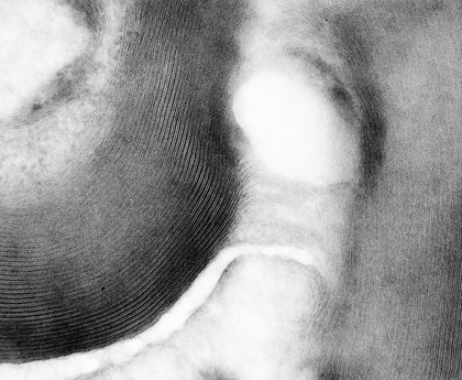 TEM - myelin sheath - detailed structure