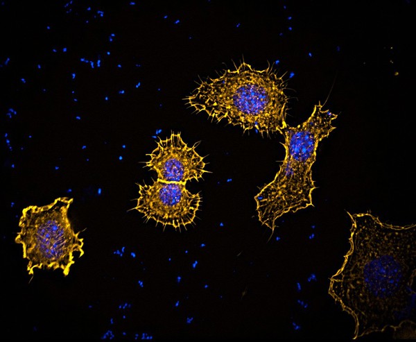 Membrane spikes and ruffles on fibroblasts