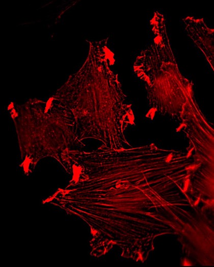Myoblasts stimulated with insulin