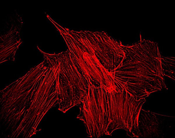 Muscle precursor cells in culture.