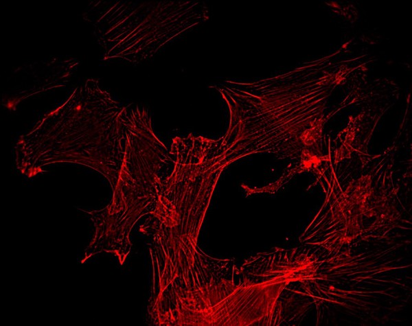 Myoblasts stimulated with insulin