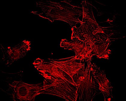 Myoblasts stimulated with insulin