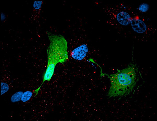 Transfected glioblastoma cells: reduced endocytosis