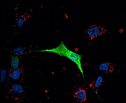 Transfected glioblastoma cells: reduced endocytosis