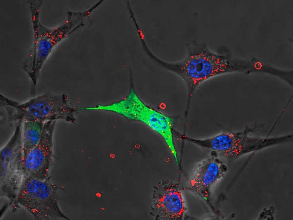 Transfected glioblastoma cells: reduced endocytosis