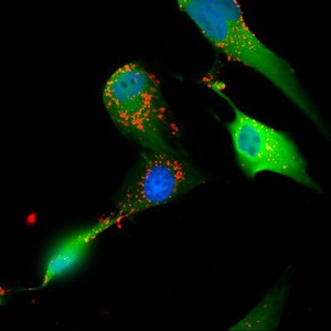 view Glioblastoma cells showing endocytosis