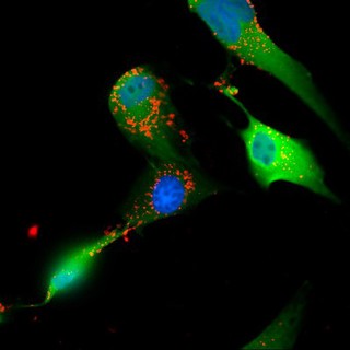 Glioblastoma cells showing endocytosis