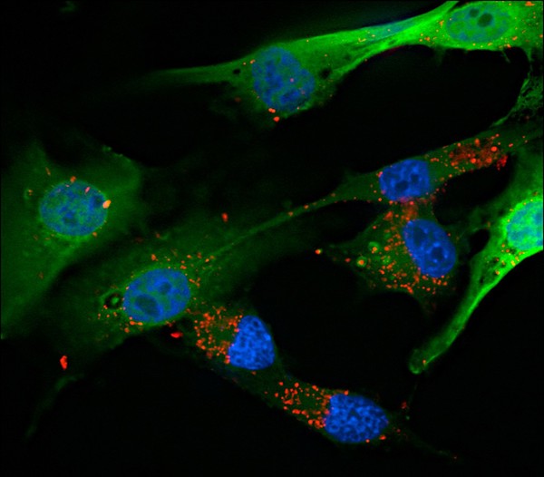 Glioblastoma cells transfected with P10