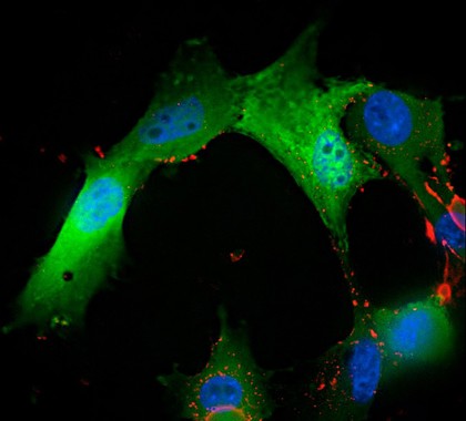 Glioblastoma cells transfected with P10