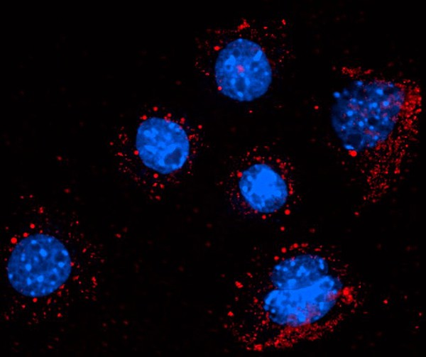 Fibroblast cells with endocytosed particles