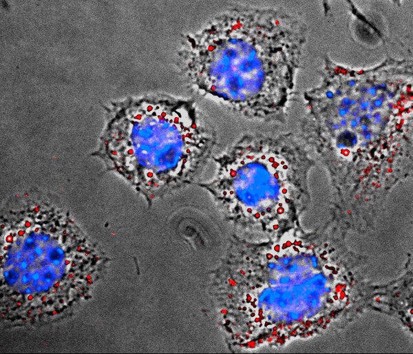 Fibroblast cells with endocytosed particles