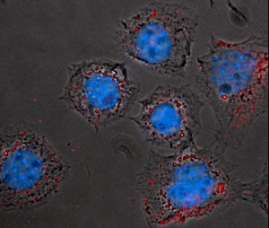 view Fibroblast cells with endocytosed particles