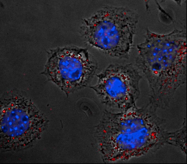 Fibroblast cells with endocytosed particles