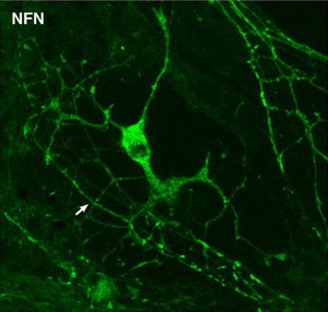 view Myelination: oligodendrocyte engaging with neurites.