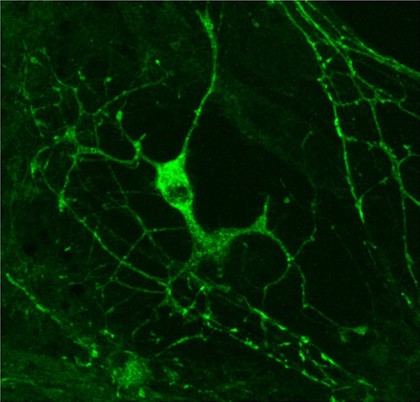 Myelination: oligodendrocyte engaging with neurites.