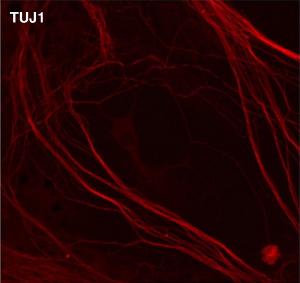 myelination