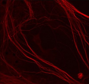 view myelination unlabelled