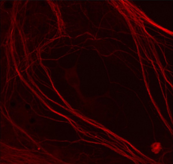 myelination unlabelled