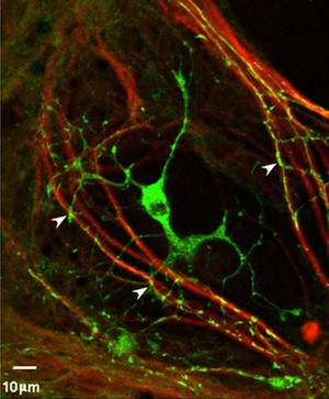 view Myelination: oligodendrocyte engaging with neurites.