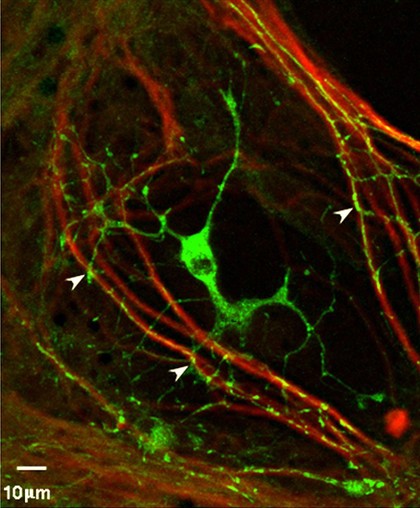 Myelination: oligodendrocyte engaging with neurites.