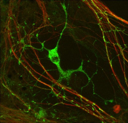 Myelination: oligodendrocyte engaging with neurites.