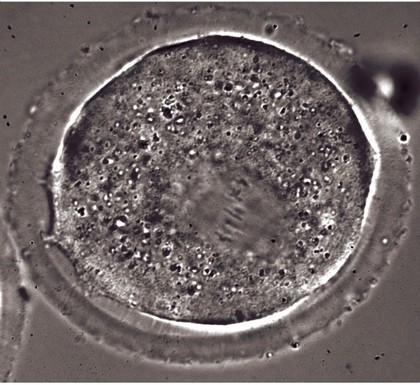 Meiosis in an oocyte