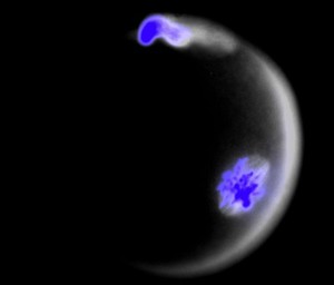 view Meiosis in an oocyte