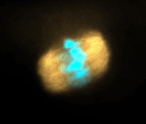 view Meiotic spindle and chromosomes