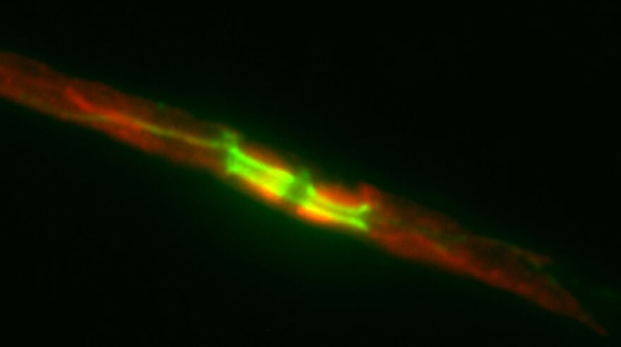 Node of Ranvier on sciatic nerve
