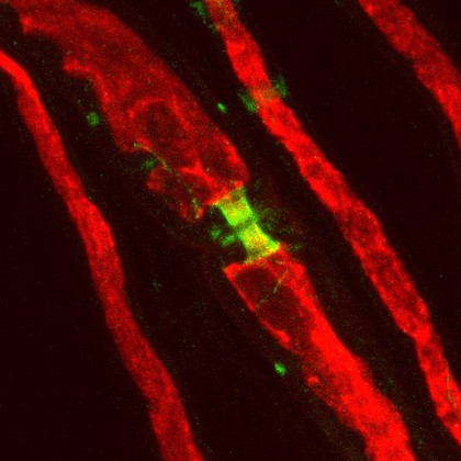 Node of Ranvier