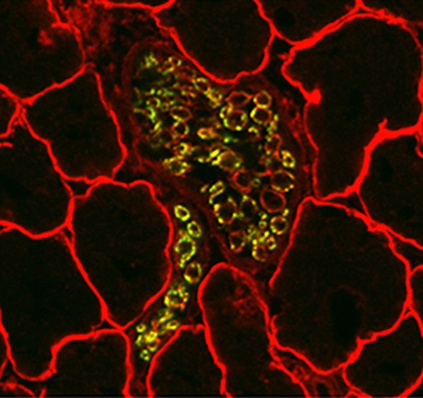 Nerve in skeletal muscle, showing dystrophin location