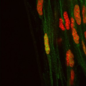 view Yoiung sciatic nerve, showing nuclei and axons