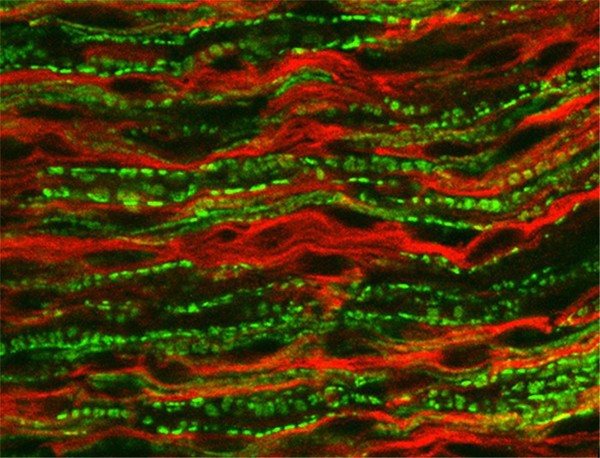 Myelination in sciatic nerve.