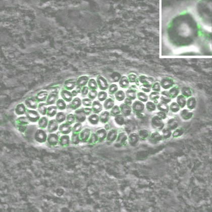 Peripheral nerve showing Schwann cells.