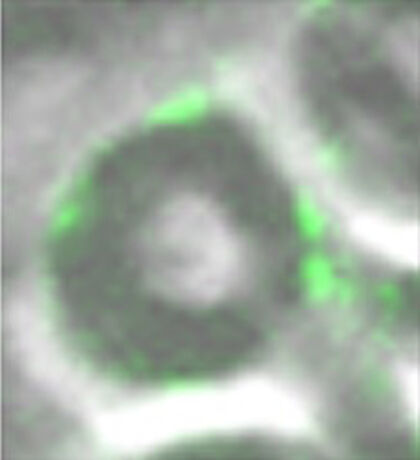 Peripheral nerve showing Schwann cells.