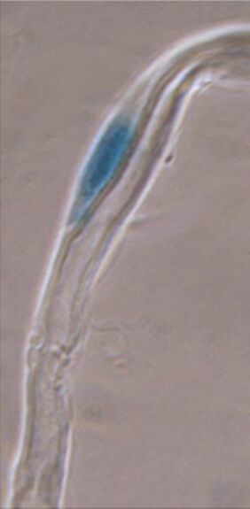 Expression of lac2 gene in sciatic nerve